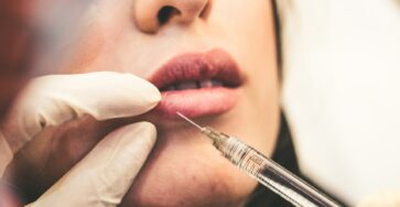 The Science of Smoothing Wrinkles Botox Insights