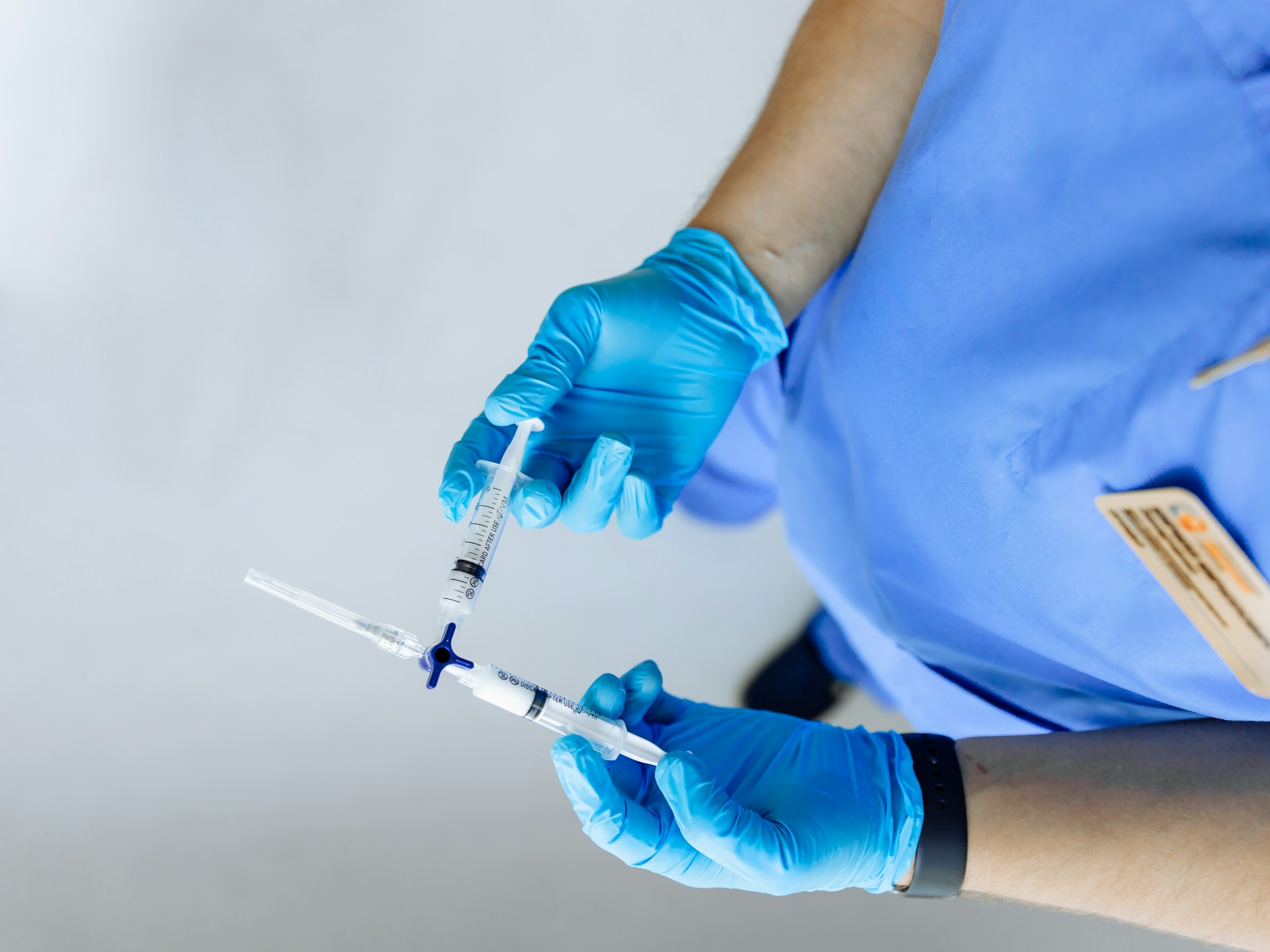 Expert Tips for Choosing the Right Varicose Veins Treatment